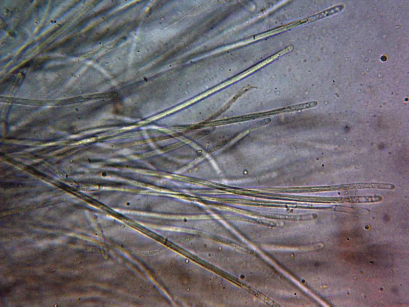 Cordyceps militaris 10 - Ascas x 400